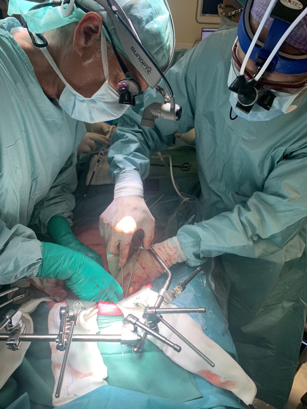 gecombineerde hart levertransplantatie UMCG